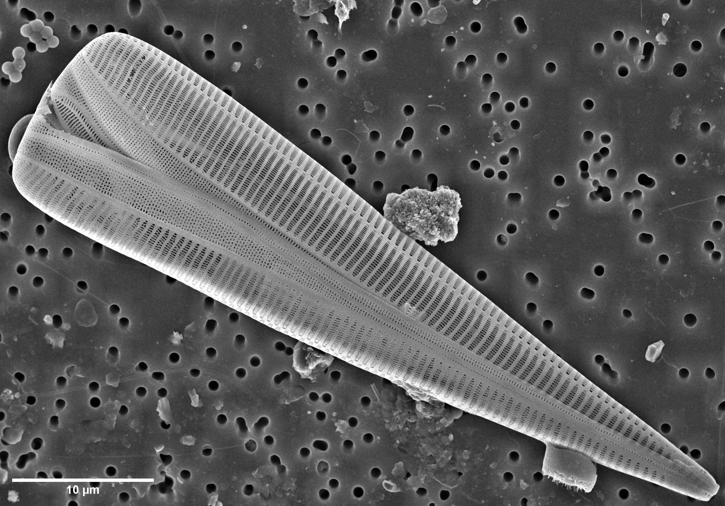 Pond water diatoms
