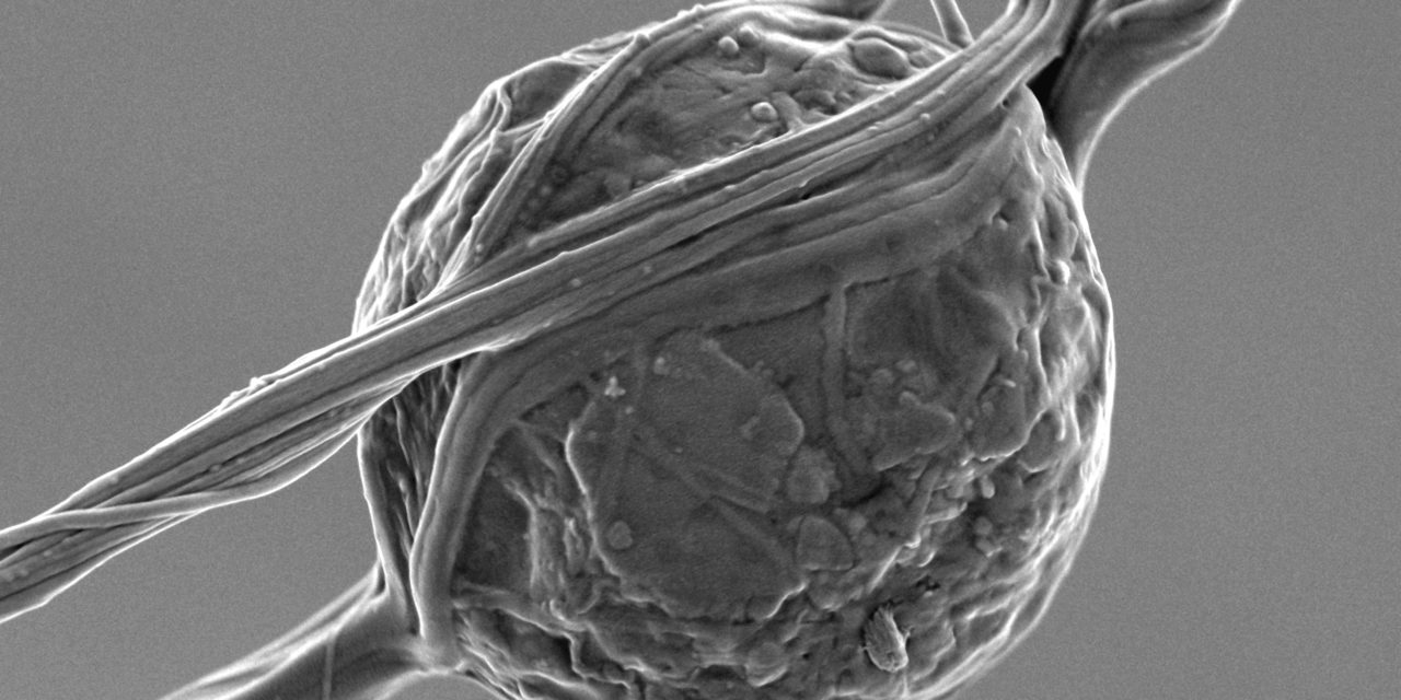 Spore trapped in spider silk, sample coated with 5 nm of Au