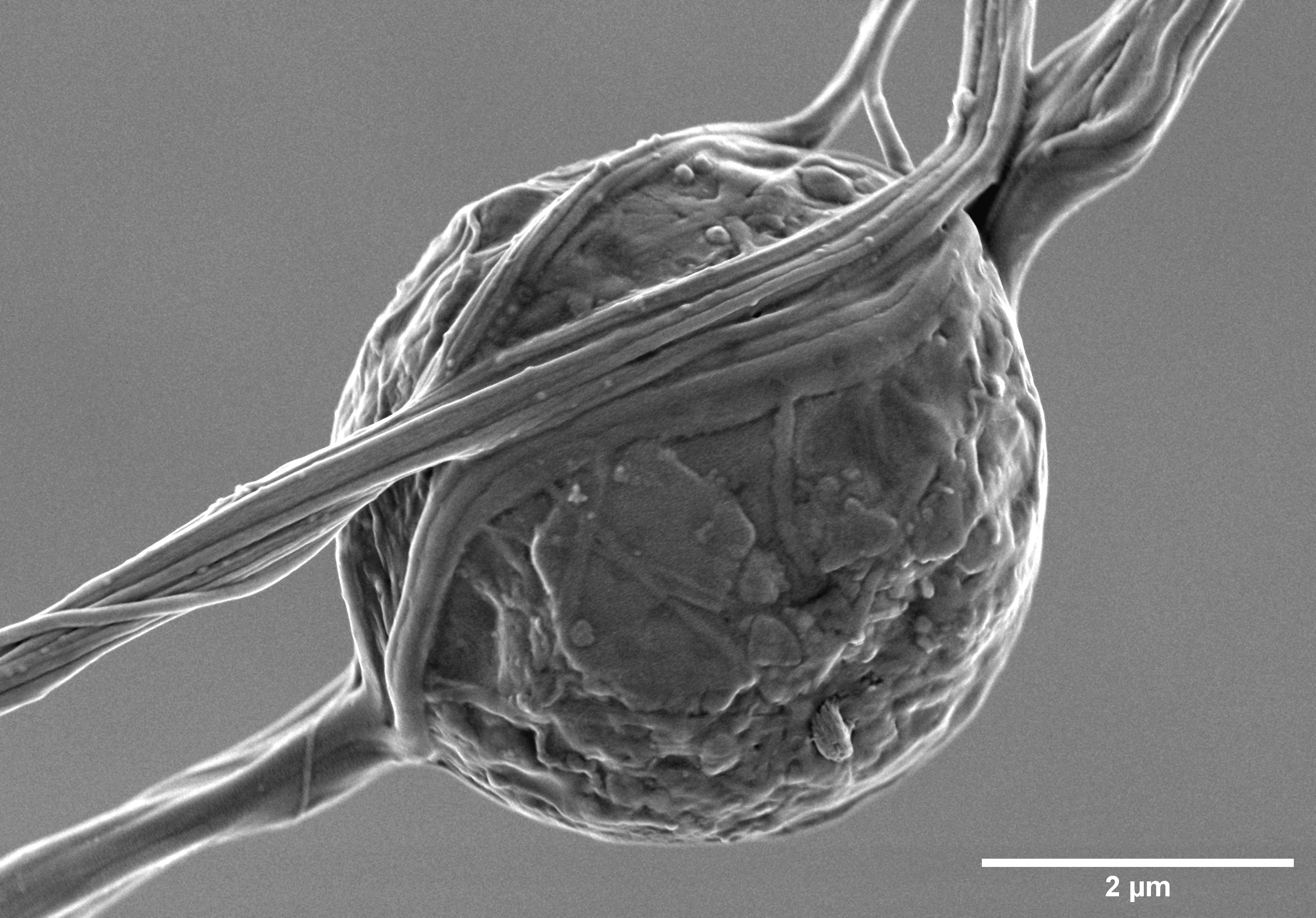 Spore trapped in spider silk, sample coated with 5 nm of Au